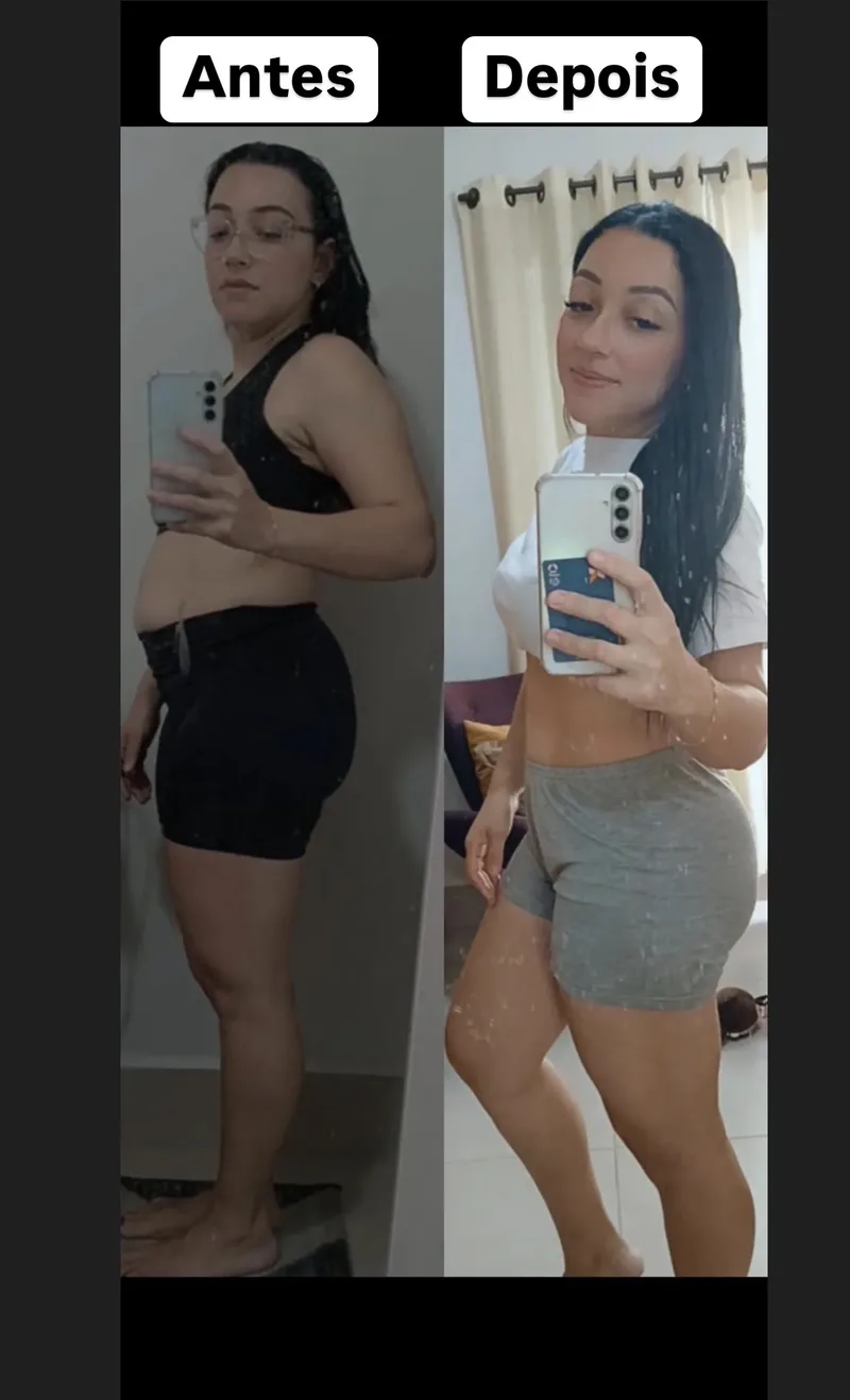 Ana Carla · antes e depois